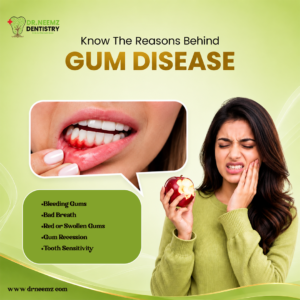 Gum diseases